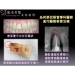 Root Canal Recovery - Result of electron